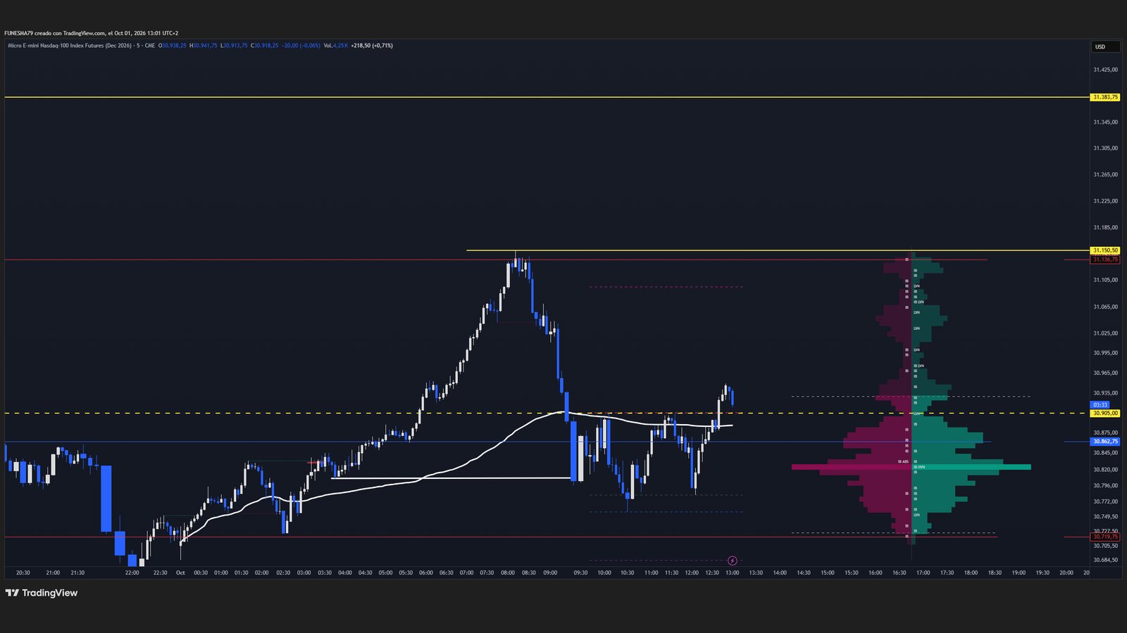 Captura real de TradingView del Micro E-mini Nasdaq-100 (MNQ) en 5 minutos con ATLAS OFI V1.1: perfil lateral de volumen comprador y vendedor a la derecha, VWAP y niveles marcados